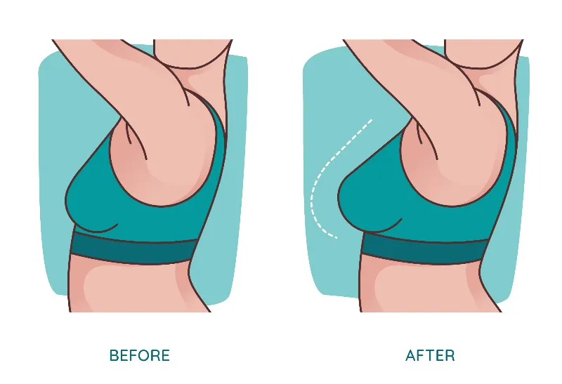 Breast Enlargement Creams